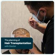 Hair Transplant Turkey - Cosmeticium